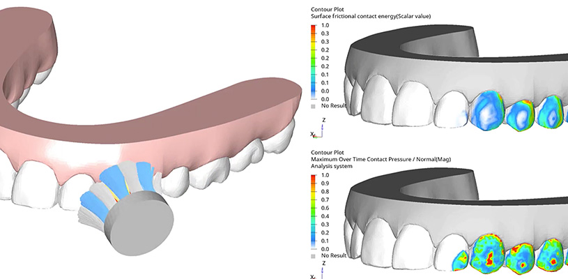 Simulation showing a circular electric toothbrush head being used on human teeth.