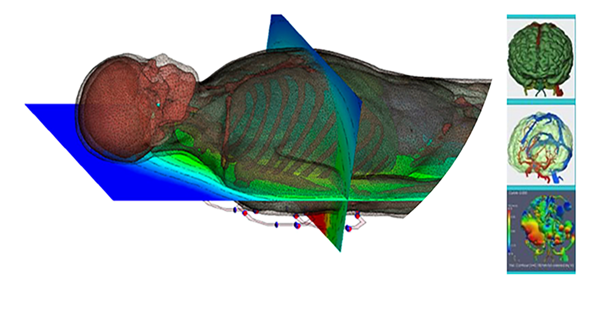 Meshing and Automation of Complex Anatomical Structures